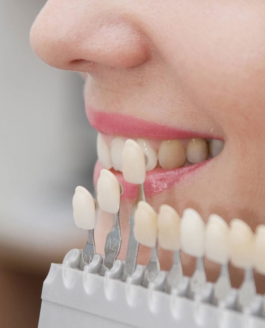 cosmetics dentist smile design and veneers treatments in pune